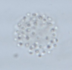 Aphanocapsa cf. incerta d=1 dcol=17 Saimaa 1 Mikonsaari 24082010 63x TS_03_17_11_23_40