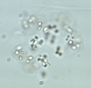 Chroococcales 1×2-2,2 Saimaa 1 Mikonsaari 60920100 63x TS_03_17_17_29_31