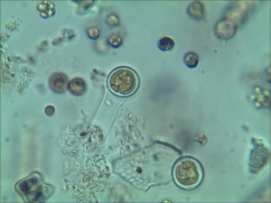 cf Chrysococcus, viiva d=11-13 Kotojärvi, Päivin näyte ph  12-07-2014 63x 0717133015