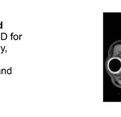 3D X-ray microscopy