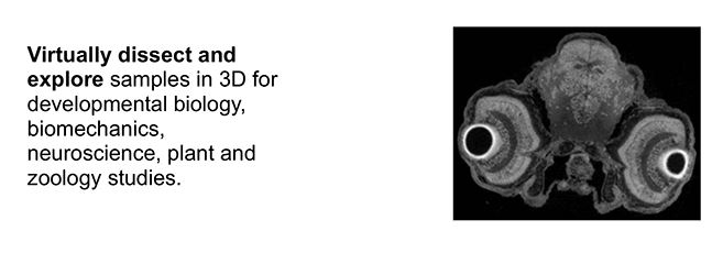 3D X-ray microscopy